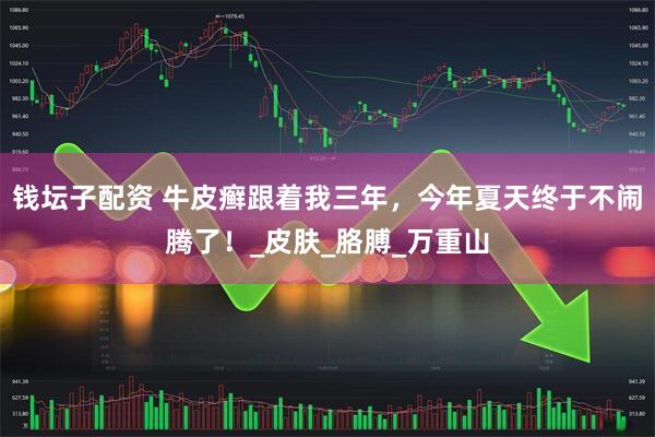 钱坛子配资 牛皮癣跟着我三年，今年夏天终于不闹腾了！_皮肤_胳膊_万重山